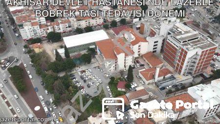 Akhisar Devlet Hastanesi’nde Lazerle Böbrek Taşı Tedavisi Dönemi