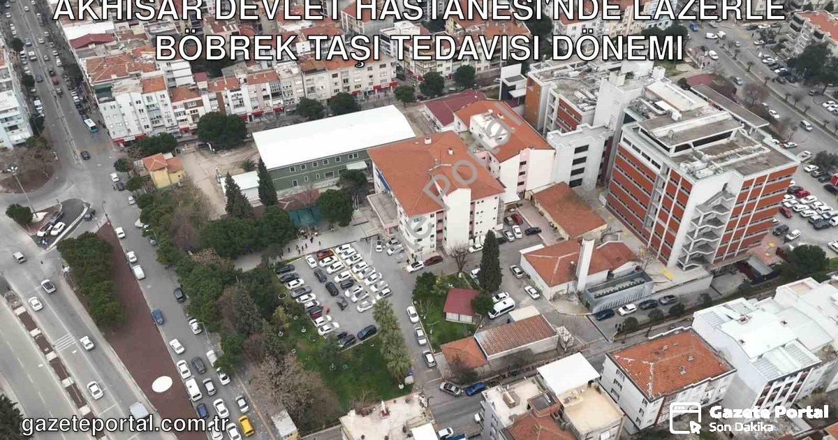 "Akhisar Devlet Hastanesi'nde Lazerle Böbrek Taşı Tedavisi Dönemi" başlıklı haber için fotorealistik